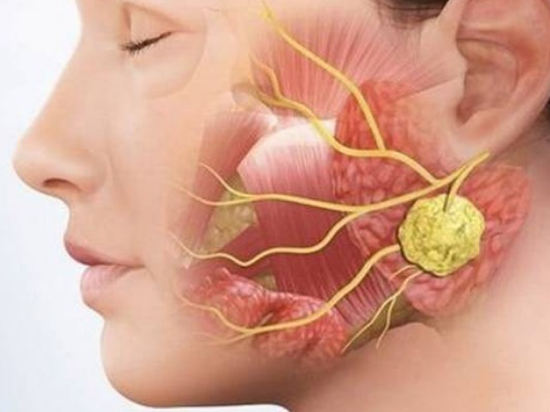 benh-nhan-moc-soi-trong-mieng