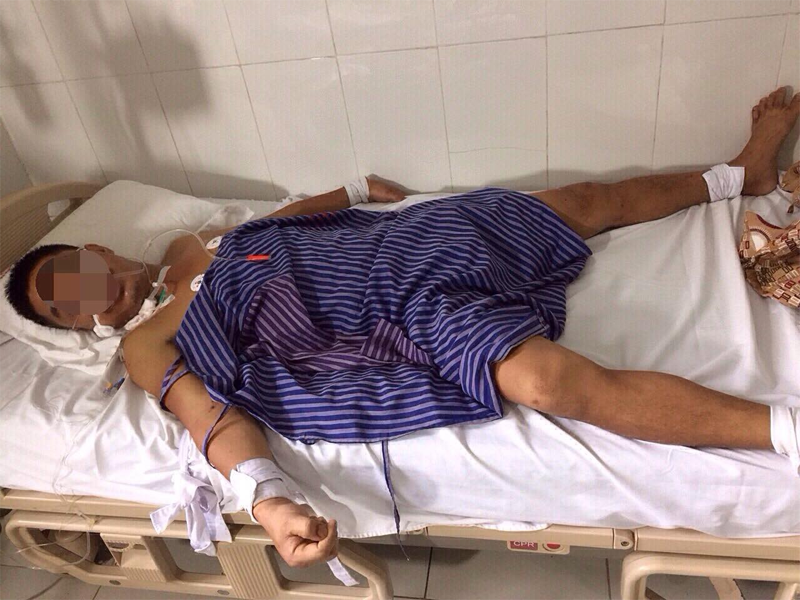 chu-quan-ong-dot-nguoi-dan-ong-bi-suy-than