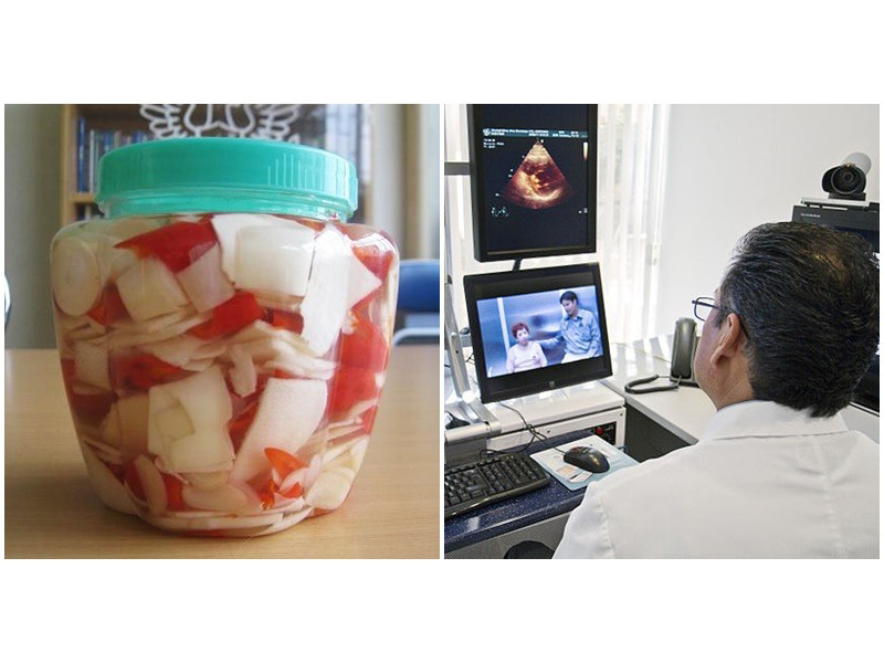 nguoi-dan-ong-35-tuoi-loet-da-day-vi-thich-an-mang-ot