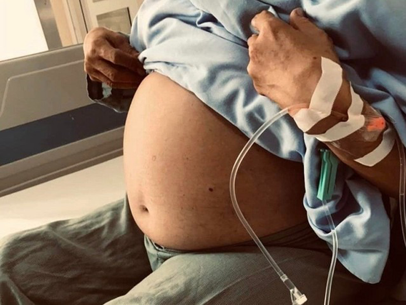 nguoi-phu-nu-ha-noi-bung-to-nhu-sap-de-tuong-an-khoe-hoa-ra-ung-thu