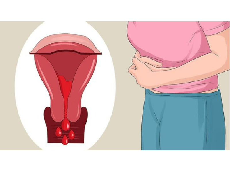 nguoi-phu-nu-man-kinh-hon-30-nam-dot-nhien-ra-mau-bat-thuong