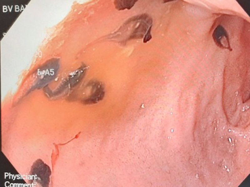 thuong-xuyen-an-goi-hai-san-bac-si-gap-ra-50-con-san-trong-mat